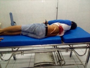Korban luka penusukan ketika dirawat dirumah sakit